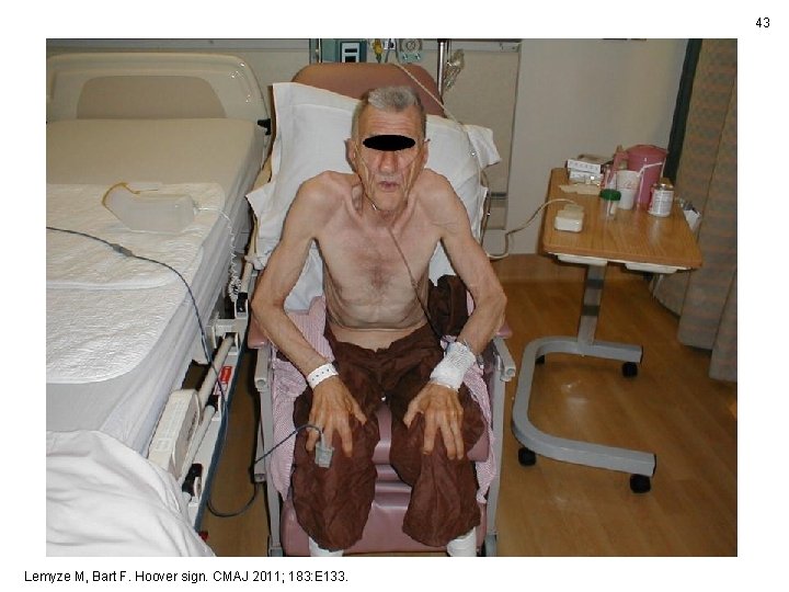 43 Lemyze M, Bart F. Hoover sign. CMAJ 2011; 183: E 133. 