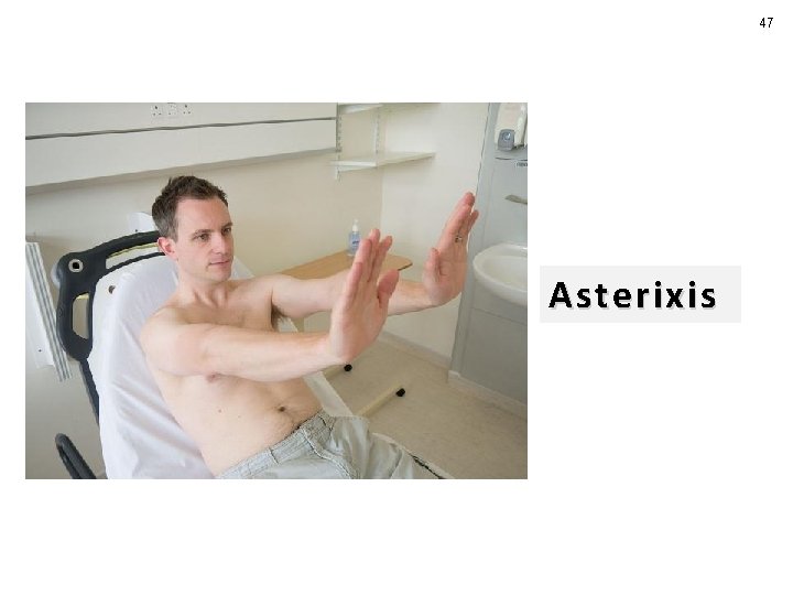 47 Asterixis 