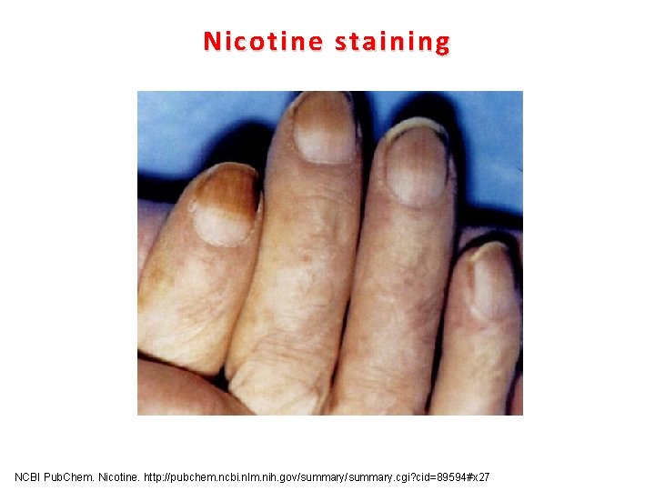Nicotine staining NCBI Pub. Chem. Nicotine. http: //pubchem. ncbi. nlm. nih. gov/summary. cgi? cid=89594#x