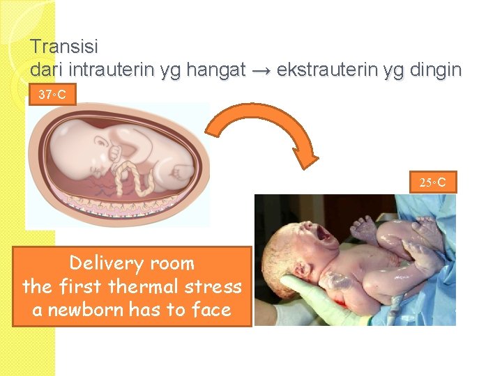 Transisi dari intrauterin yg hangat → ekstrauterin yg dingin 37◦C 25◦C Delivery room the