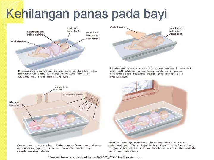 Kehilangan panas pada bayi 