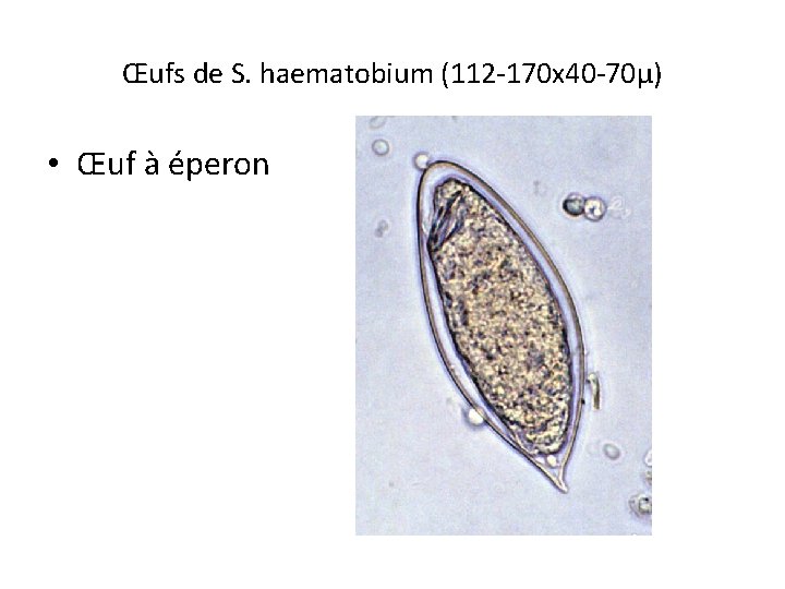 Œufs de S. haematobium (112 -170 x 40 -70µ) • Œuf à éperon 