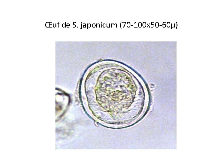 Œuf de S. japonicum (70 -100 x 50 -60µ) ; 