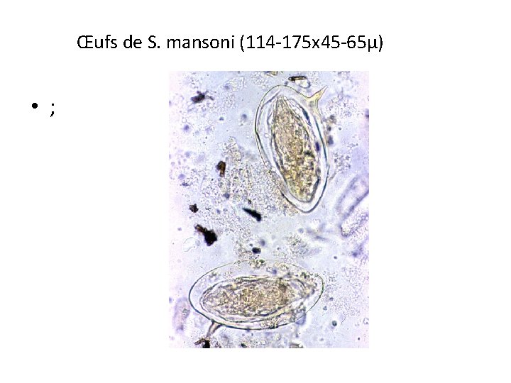 Œufs de S. mansoni (114 -175 x 45 -65µ) • ; 