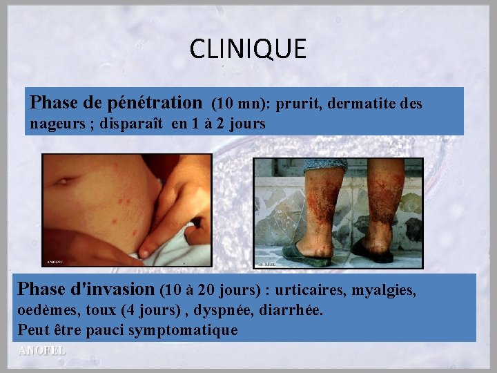 CLINIQUE Phase de pénétration (10 mn): prurit, dermatite des nageurs ; disparaît en 1