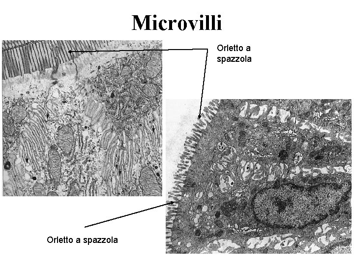 Microvilli Orletto a spazzola 