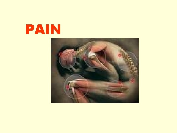 PAIN 
