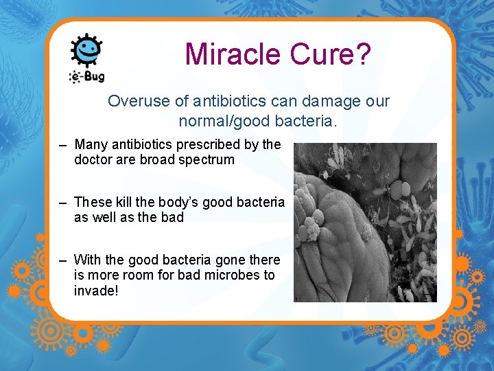 Miracle Cure? Overuse of antibiotics can damage our normal/good bacteria. – Many antibiotics prescribed