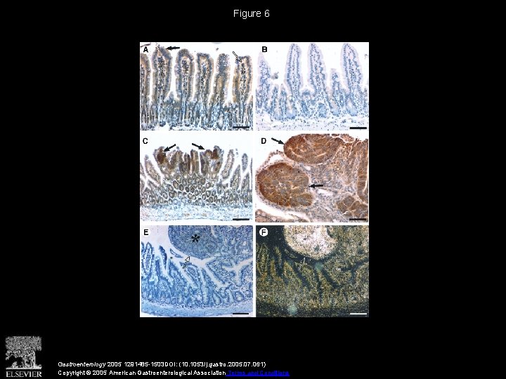 Figure 6 Gastroenterology 2005 1291485 -1503 DOI: (10. 1053/j. gastro. 2005. 07. 061) Copyright