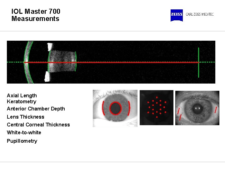 IOL Master 700 Measurements Axial Length Keratometry Anterior Chamber Depth Lens Thickness Central Corneal