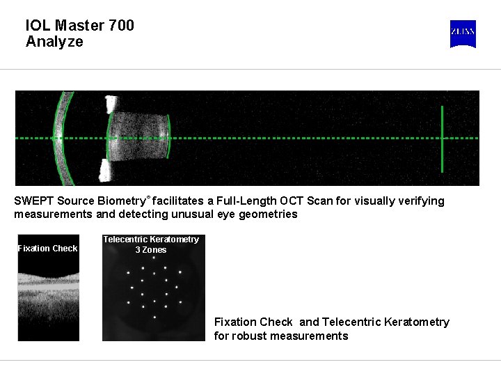 IOL Master 700 Analyze SWEPT Source Biometry® facilitates a Full-Length OCT Scan for visually