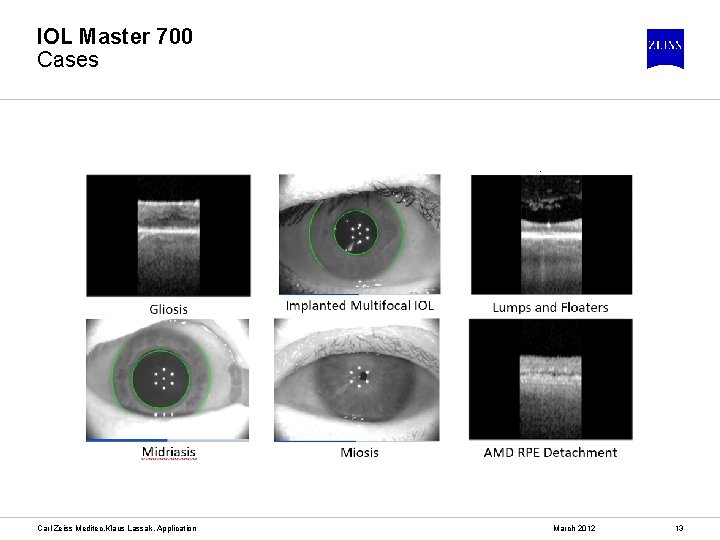 IOL Master 700 Cases Carl Zeiss Meditec, Klaus Lassak, Application March 2012 13 