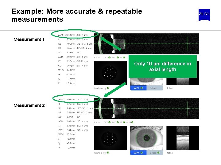 Example: More accurate & repeatable measurements Measurement 1 Only 10 µm difference in axial