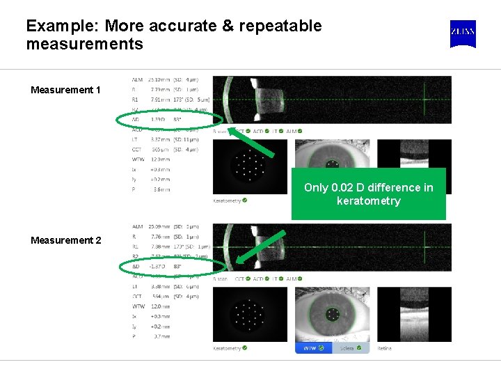 Example: More accurate & repeatable measurements Measurement 1 Only 0. 02 D difference in