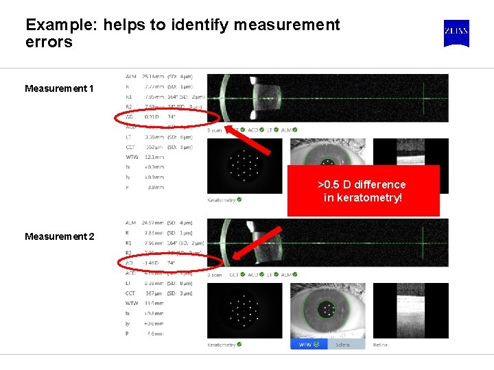Example: helps to identify measurement errors Measurement 1 >0. 5 D difference in keratometry!