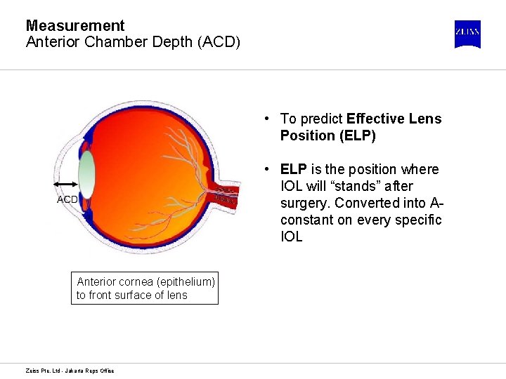 Measurement Anterior Chamber Depth (ACD) • To predict Effective Lens Position (ELP) • ELP