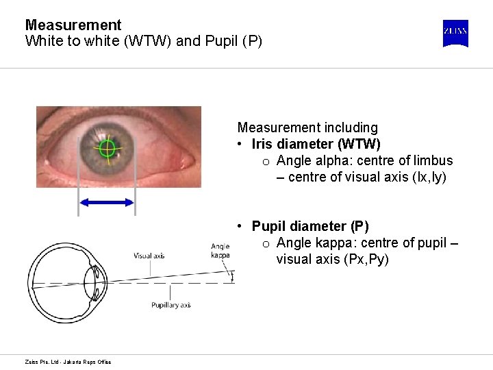 Measurement White to white (WTW) and Pupil (P) Measurement including • Iris diameter (WTW)