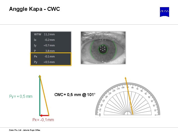 Anggle Kapa - CWC = 0, 5 mm @ 101° Py = + 0,