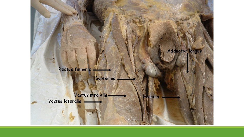 Adductor longus Rectus femoris Sartorius Vastus medialis Vastus lateralis Gracilis 
