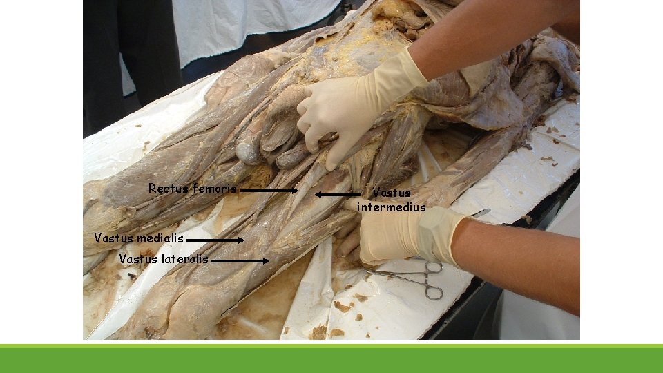 Rectus femoris Vastus medialis Vastus lateralis Vastus intermedius 