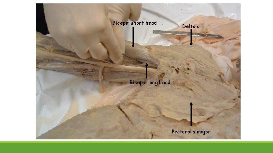 Biceps: short head Deltoid Biceps: long head Pectoralis major 