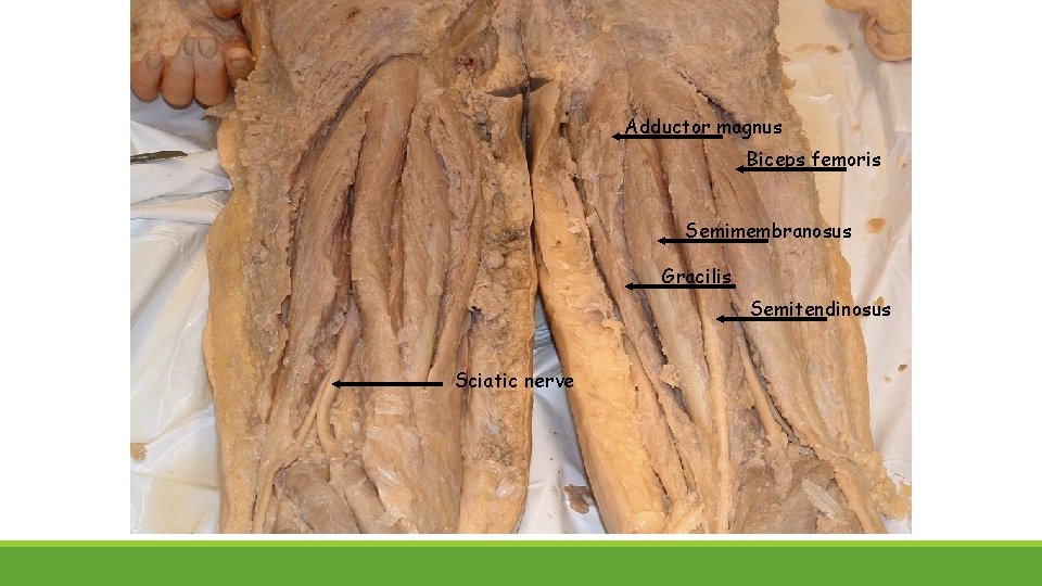 Adductor magnus Biceps femoris Semimembranosus Gracilis Semitendinosus Sciatic nerve 