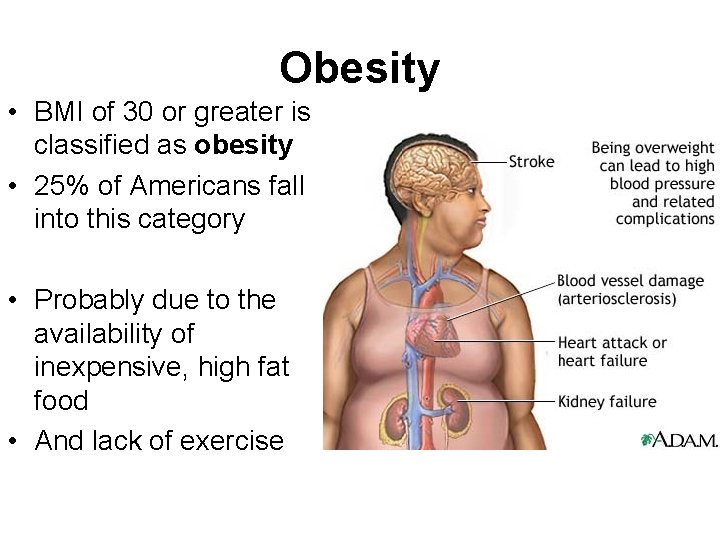 Obesity • BMI of 30 or greater is classified as obesity • 25% of