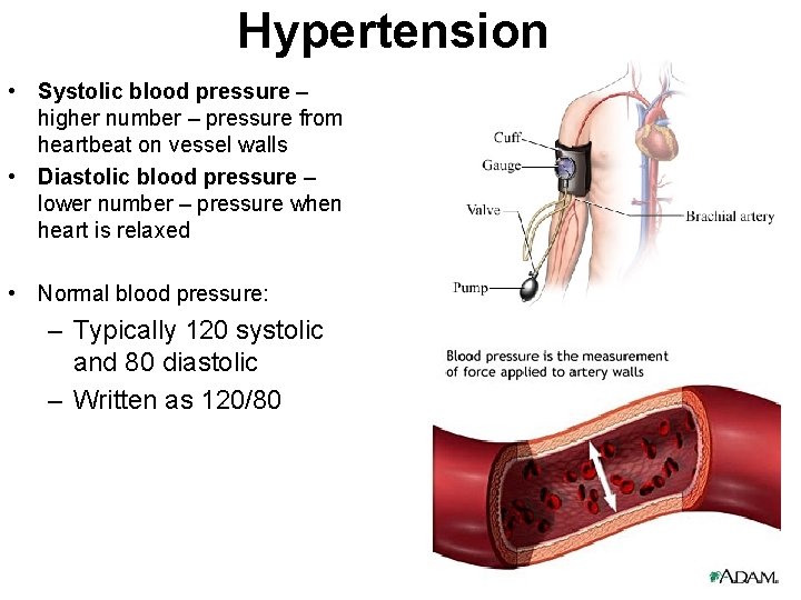 Hypertension • Systolic blood pressure – higher number – pressure from heartbeat on vessel