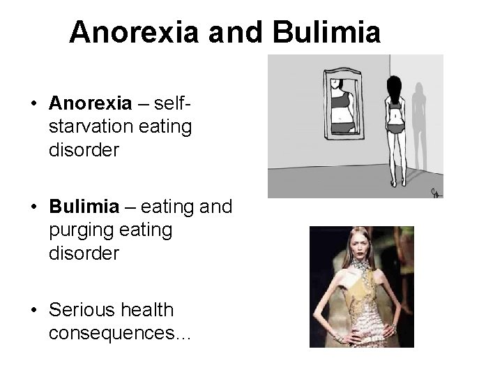 Anorexia and Bulimia • Anorexia – selfstarvation eating disorder • Bulimia – eating and