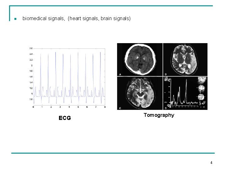 n biomedical signals, (heart signals, brain signals) ECG Tomography 4 