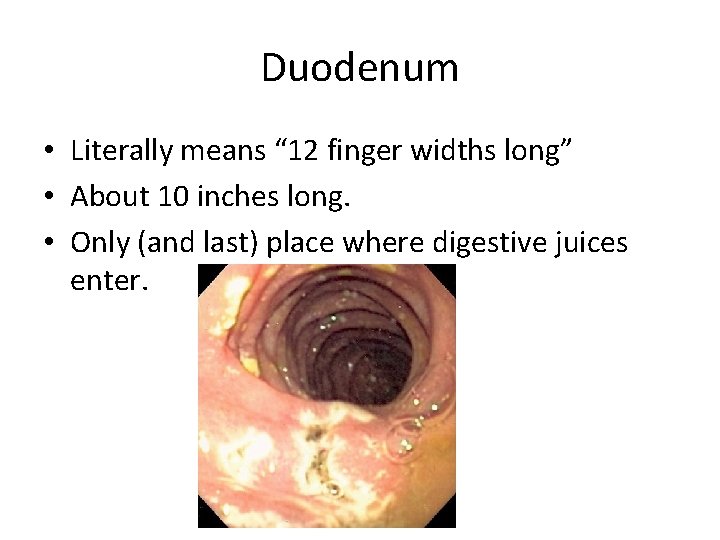 Duodenum • Literally means “ 12 finger widths long” • About 10 inches long.