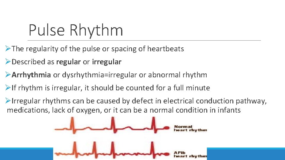 Pulse Rhythm ØThe regularity of the pulse or spacing of heartbeats ØDescribed as regular