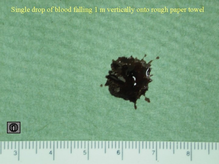 Single drop of blood falling 1 m vertically onto rough paper towel 1 towel