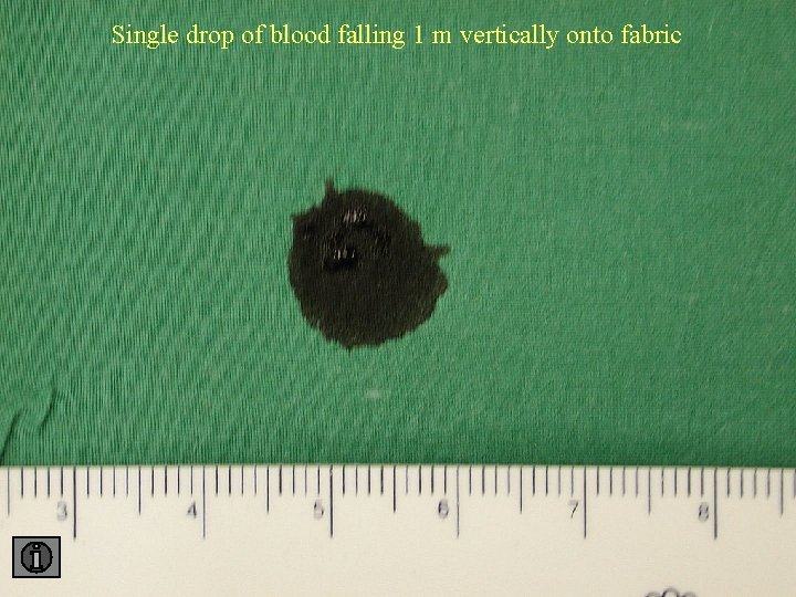 Single drop of blood falling 1 m vertically onto fabric 1 fabric 