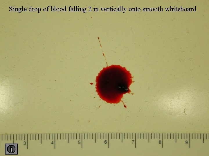 Single drop of blood falling 2 m vertically onto smooth whiteboard 2 smooth 