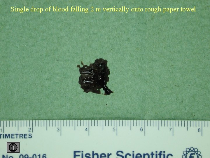 Single drop of blood falling 2 m vertically onto rough paper towel 2 towel