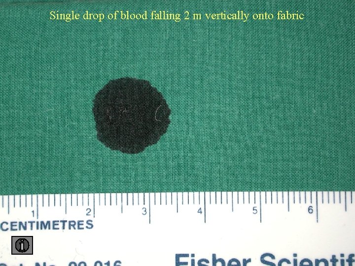 Single drop of blood falling 2 m vertically onto fabric 2 fabric 
