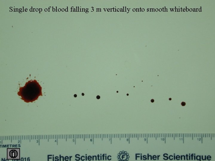 Single drop of blood falling 3 m vertically onto smooth whiteboard 3 smooth 
