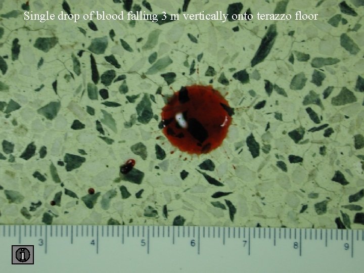 Single drop of blood falling 3 m vertically onto terazzo floor 3 floor 