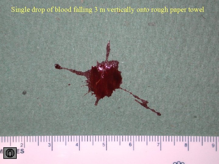 Single drop of blood falling 3 m vertically onto rough paper towel 3 towel