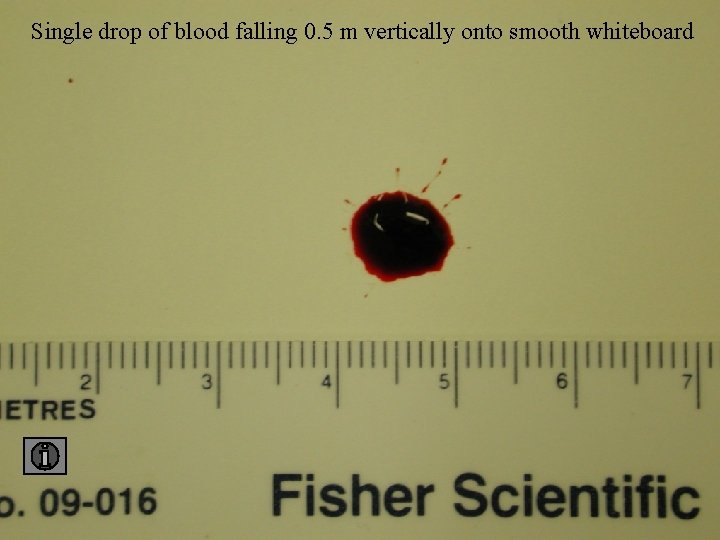 Single drop of blood falling 0. 5 m vertically onto smooth whiteboard 0. 5