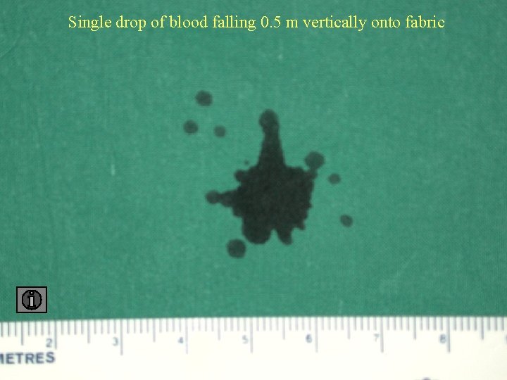 Single drop of blood falling 0. 5 m vertically onto fabric 0. 5 fabric