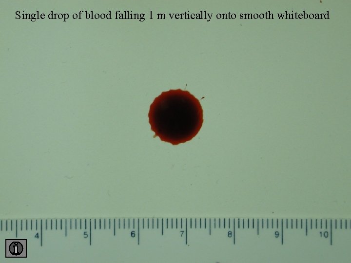 Single drop of blood falling 1 m vertically onto smooth whiteboard 1 smooth 