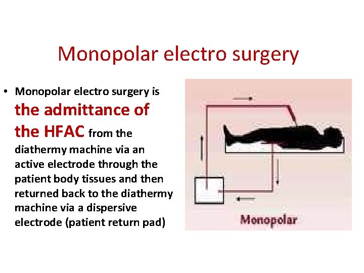 Monopolar electro surgery • Monopolar electro surgery is the admittance of the HFAC from