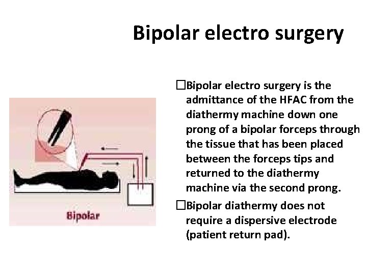 Bipolar electro surgery �Bipolar electro surgery is the admittance of the HFAC from the