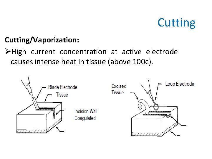 Cutting/Vaporization: ØHigh current concentration at active electrode causes intense heat in tissue (above 100