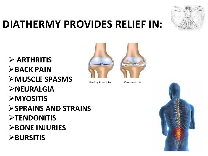 DIATHERMY PROVIDES RELIEF IN: Ø ARTHRITIS ØBACK PAIN ØMUSCLE SPASMS ØNEURALGIA ØMYOSITIS ØSPRAINS AND