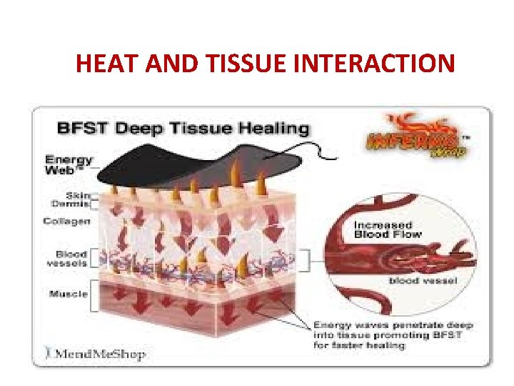 HEAT AND TISSUE INTERACTION 