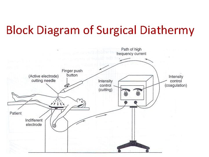 Block Diagram of Surgical Diathermy 