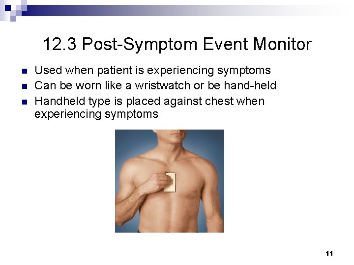 12. 3 Post-Symptom Event Monitor n n n Used when patient is experiencing symptoms